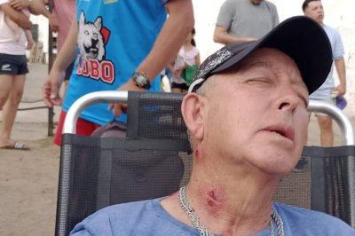 Partido de fútbol terminó con disturbios y dos periodistas resultaron heridos con balas de goma
