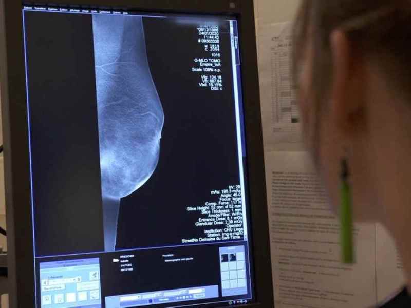 Otro efecto pandemia: se postergaron controles para prevenir tres formas frecuentes de cáncer