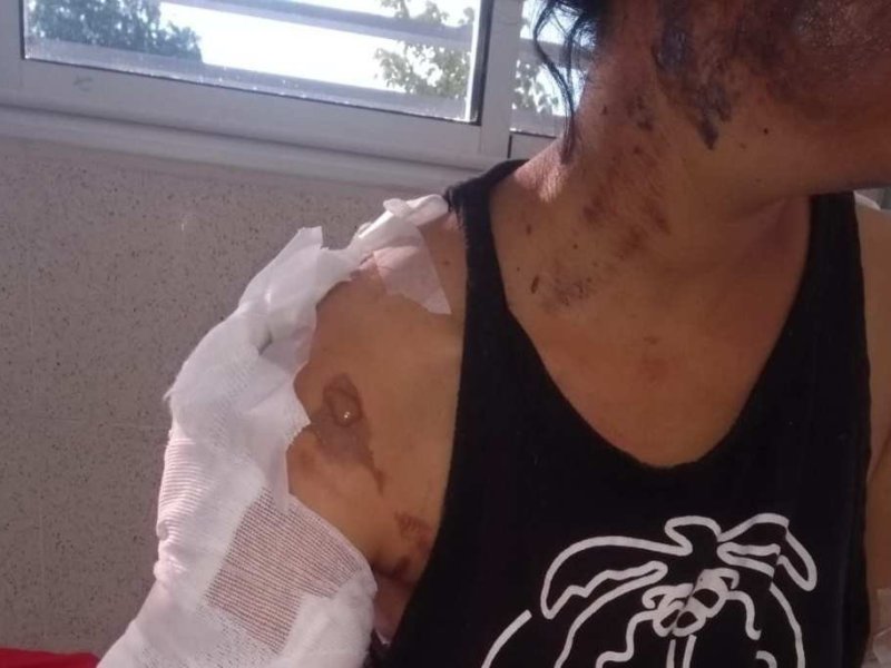 Se entregó el hombre que le prendió fuego a su exnovia en Coronda