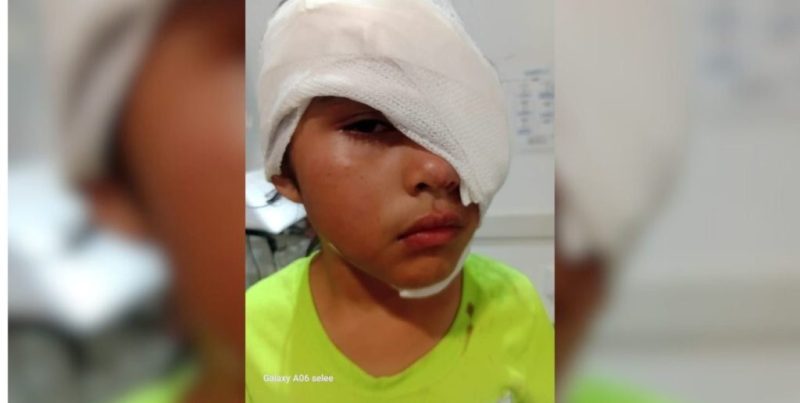 Niña sufrió heridas graves en el rostro tras un ataque de perro pitbull en Santa Fe