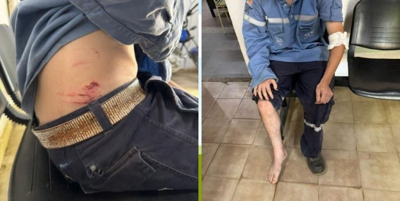 Un operario de la EPE resultó con graves heridas tras ser atacado por una jauría en la capital santafesina