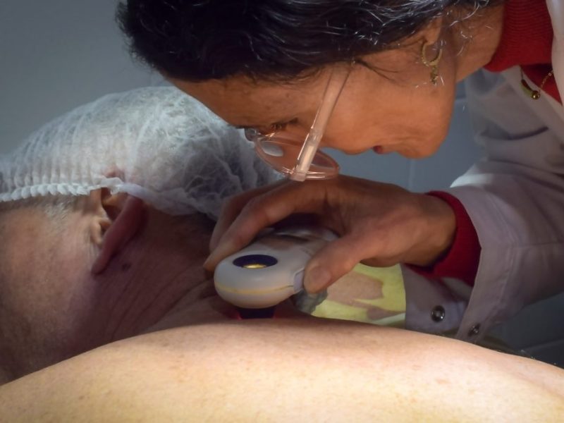 Ministerio de Salud de Entre Ríos impulsa la consulta precoz de lesiones para prevenir el cáncer de piel