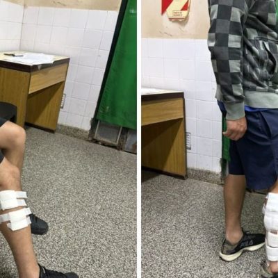 Baleracera en Alto Verde: dos hermanos heridos y un motociclista lesionado en accidente en la zona norte de Santa Fe
