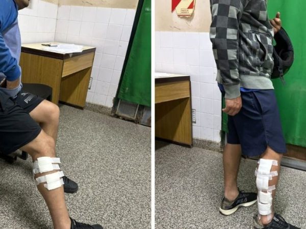 Baleracera en Alto Verde: dos hermanos heridos y un motociclista lesionado en accidente en la zona norte de Santa Fe