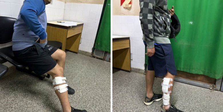 Baleracera en Alto Verde: dos hermanos heridos y un motociclista lesionado en accidente en la zona norte de Santa Fe